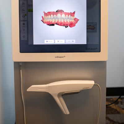 Trios-digital-impression-scanner