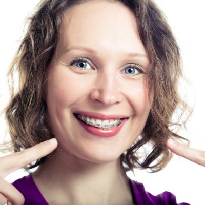 Woman smiling and pointing to her braces