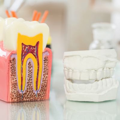 Bite and tooth models