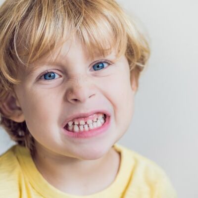 Facial Growth Orthodontic