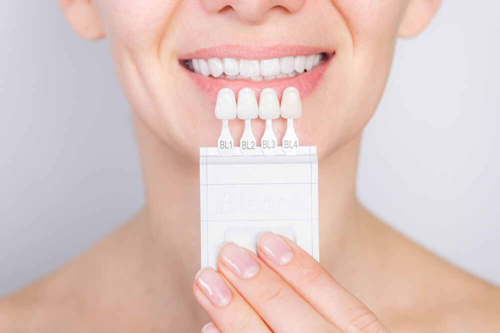 Porcelain Veneers