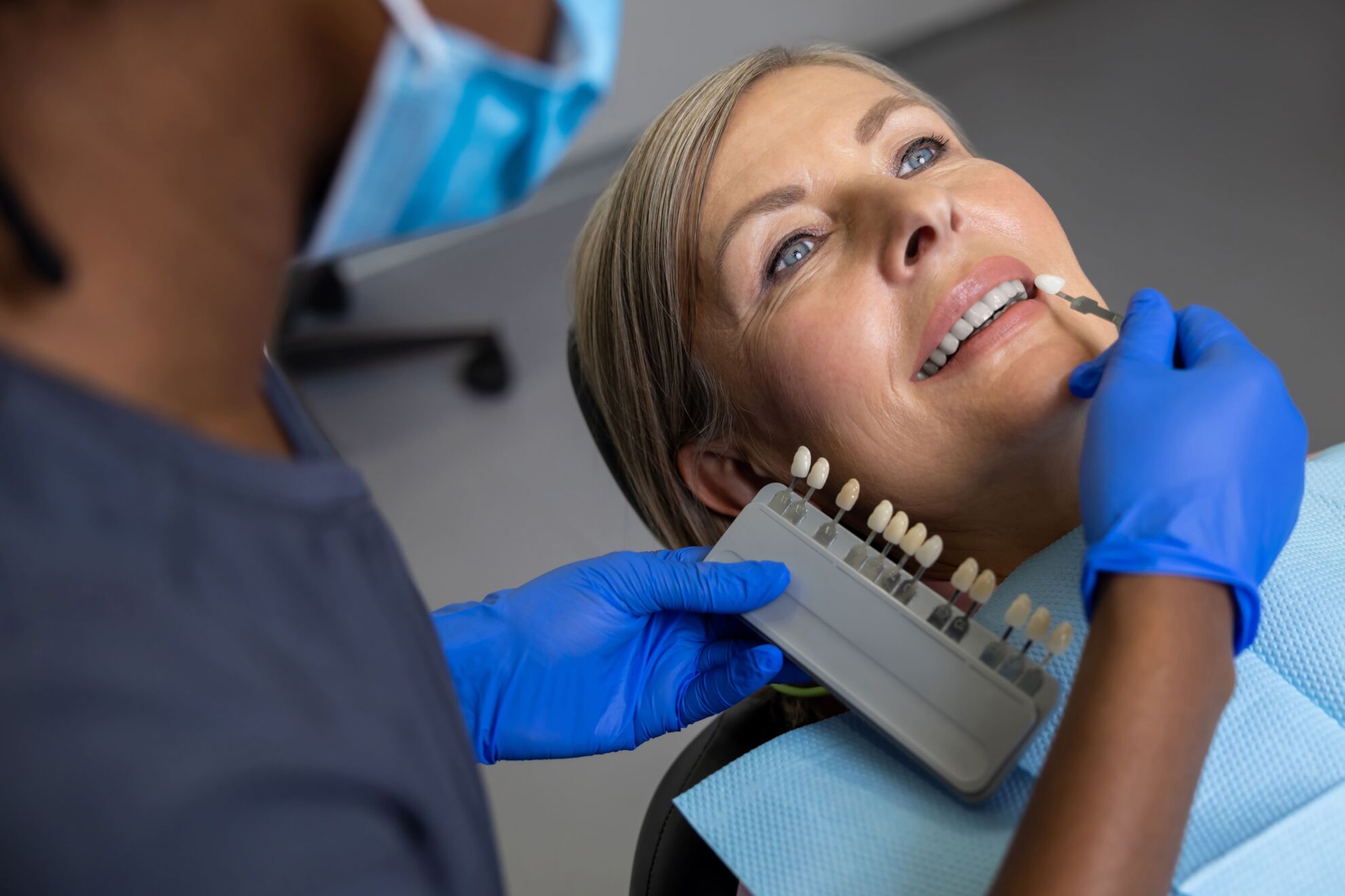 Traditional vs No-Prep Veneers