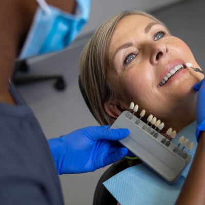 Traditional vs No-Prep Veneers